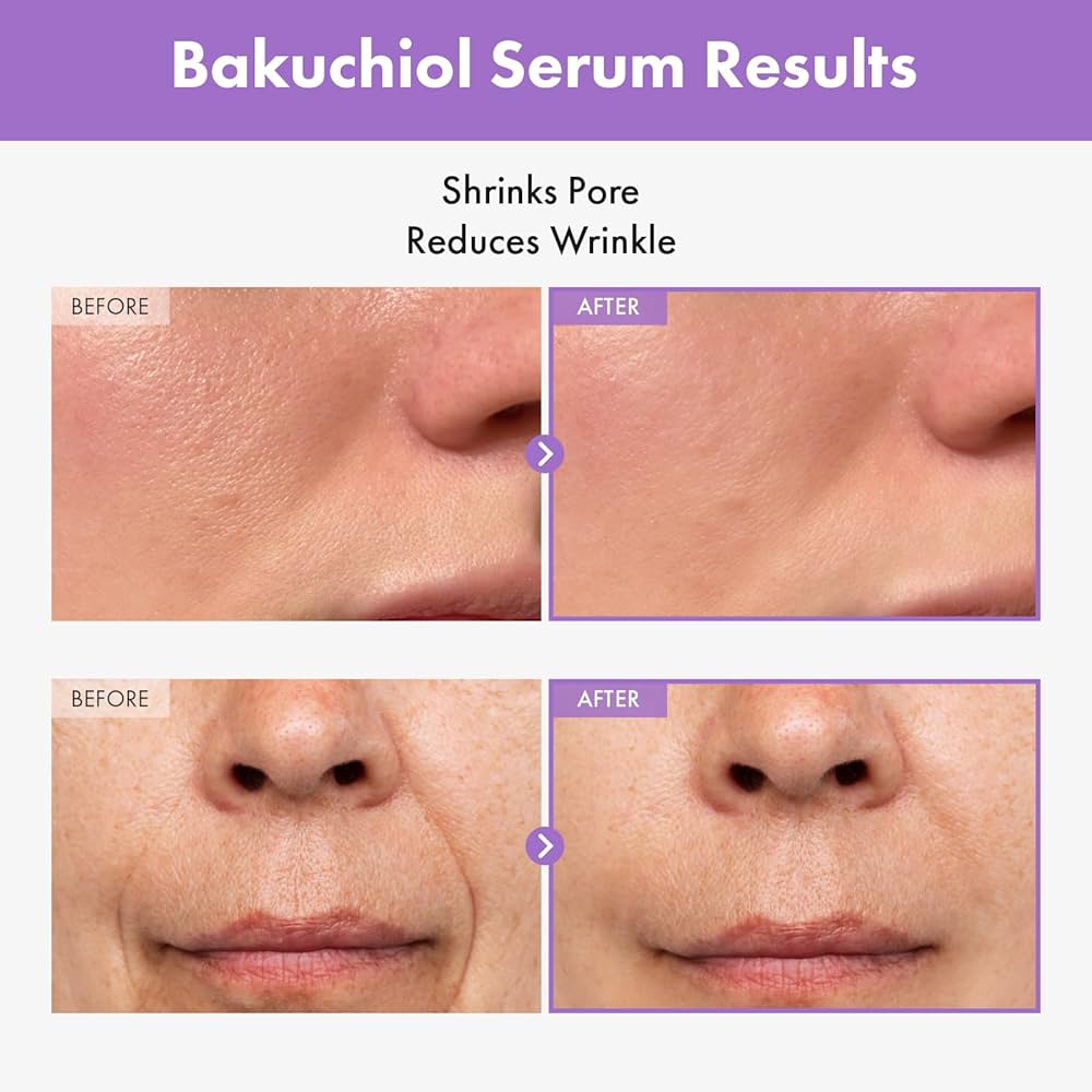 Amazon.com: TOSOWOONG Bakuchiol Serum, 5,000ppm Bakuchiol